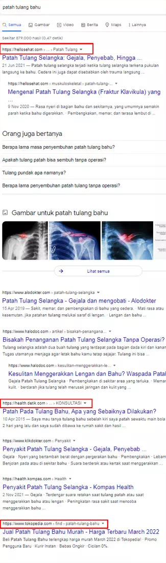 SERP keyword patah tulang bahu